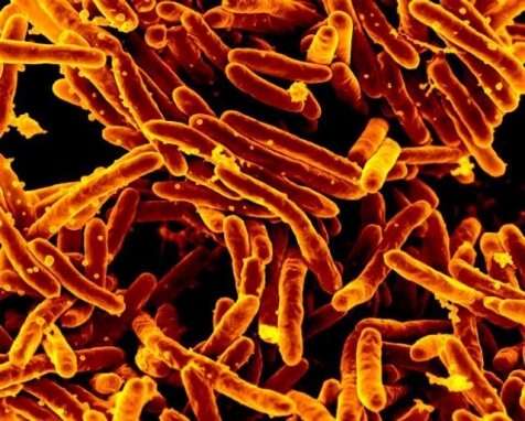 Study shows high TB risk in kids exposed to disease
