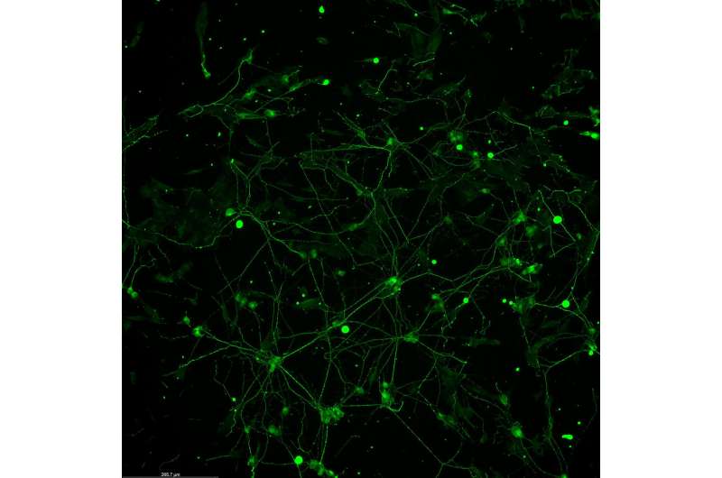 Synthetic neurons project offers platform for disease treatment, further brain research