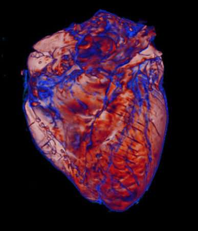 Team uses imaging to study ways the heart is affected by coronavirus