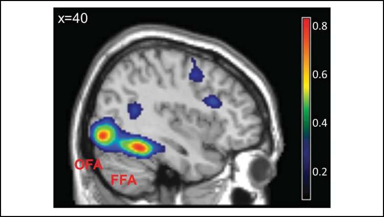 The brain's facial recognition area doesn't differentiate outgroup members