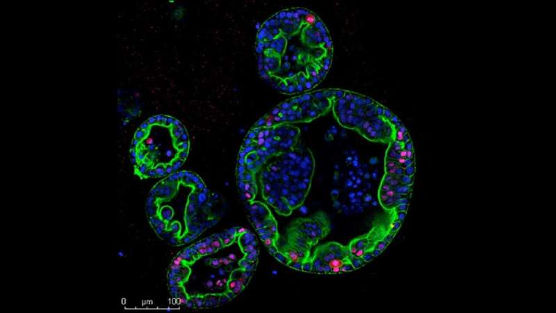 The first mouse model of human pancreas cancer subtypes