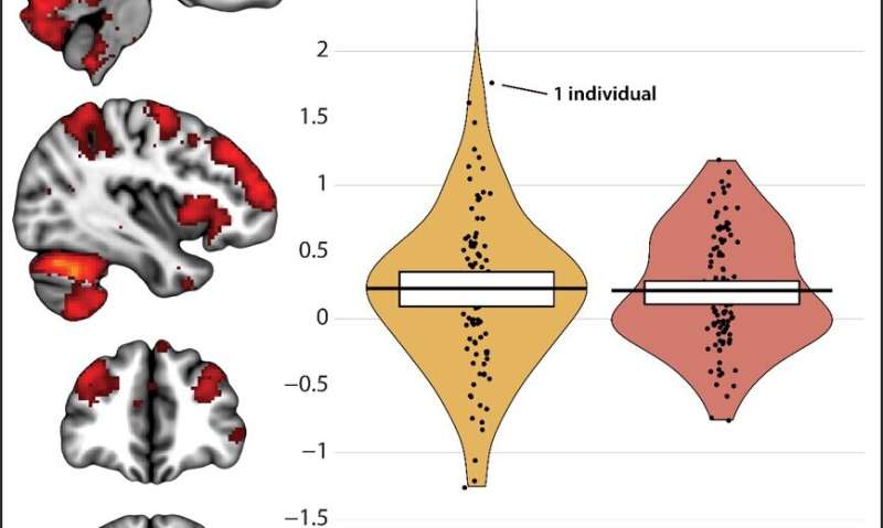 The overlap between fear and anxiety brain circuits