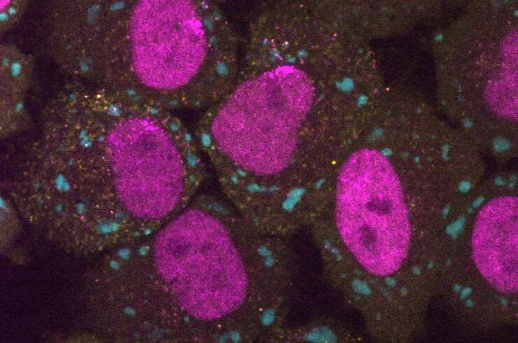 Thinking afresh about how cells respond to stress