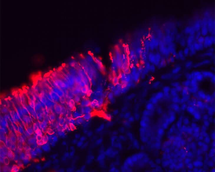 Thriving neuron 'nursery' found in a section of adult human nose tissue