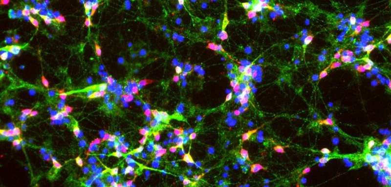 Tiny brain “tweezers” could hold the key to treating Parkinson’s Disease