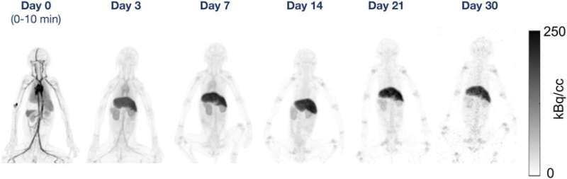 Total-body PET imaging successfully identifies antibodies up to 30 days after injection