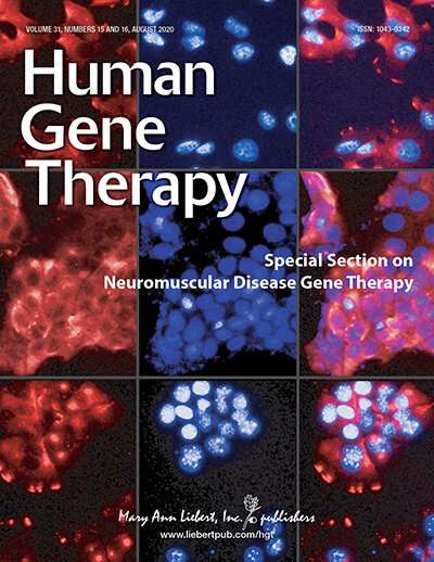 Toxicity of dorsal root ganglia is widely associated with CNS AAV gene therapy