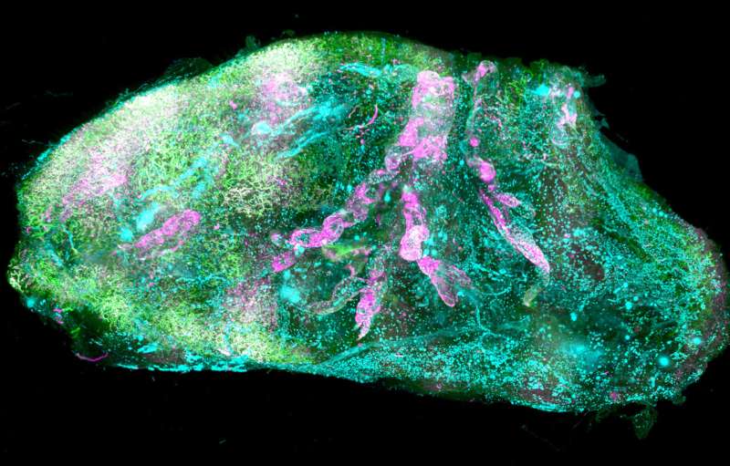 Transparent human organs allow 3D maps at the cellular level