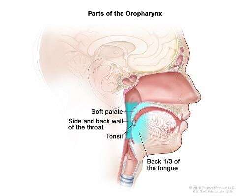 hpv throat cancer chemo)