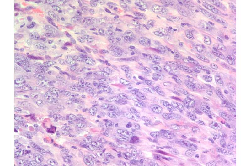 Two drugs used in combination prove to be effective against most aggressive asbestos cancer in mice