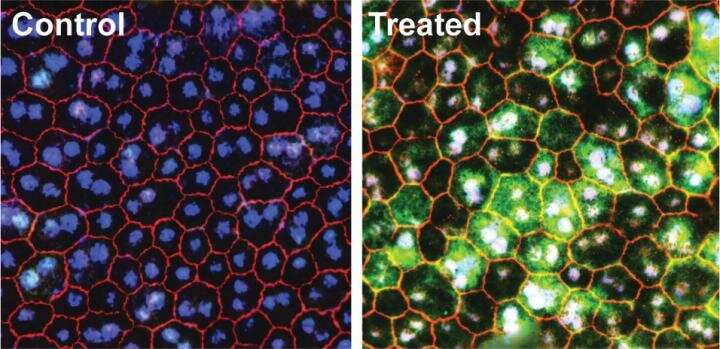 UCI-led study reveals restoration of retinal and visual function following gene therapy