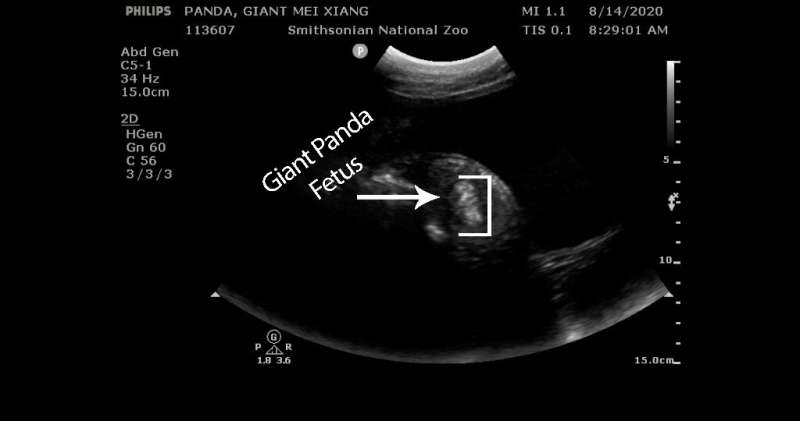 Ultrasound of the giant panda Mei Xiang, who the National Zoo announced is pregnant