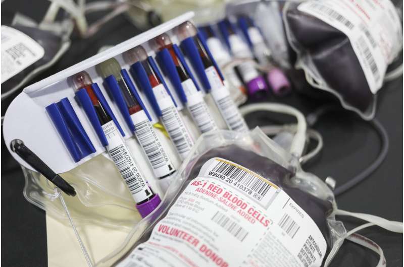 US eases blood donation limits for gay men due to shortage