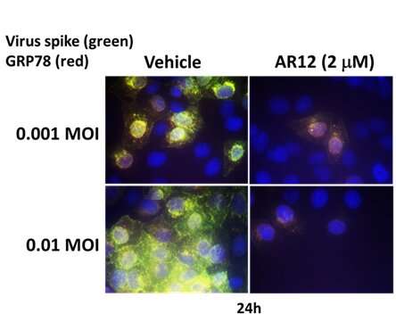 VCU study shows the experimental drug AR-12 could be a promising COVID-19 treatment