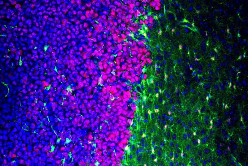 Virginia Tech scientists reveal brain tumors impact normally helpful cells
