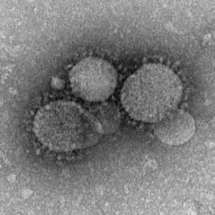 Virologist discusses coronavirus