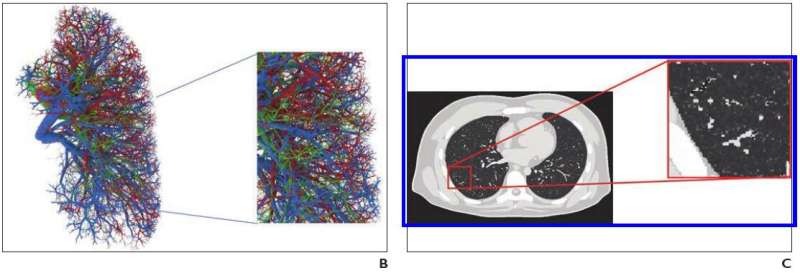 Virtual imaging trials optimize CT, radiography for coronavirus disease (COVID-19)