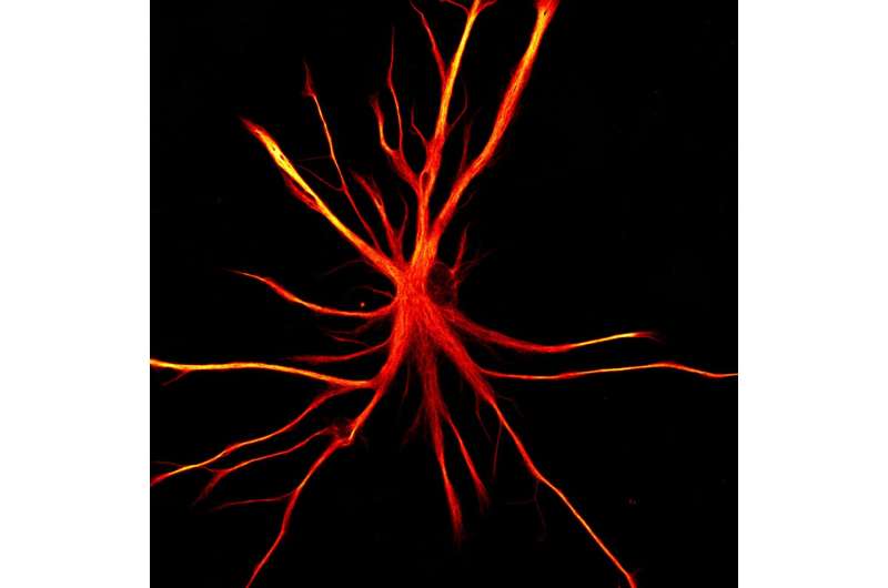 When astrocytes attack: Stem cell model shows possible mechanism behind neurodegeneration