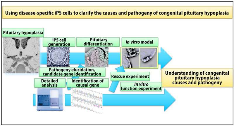World's first congenital pituitary hypoplasia model developed using patient-derived iPS cells