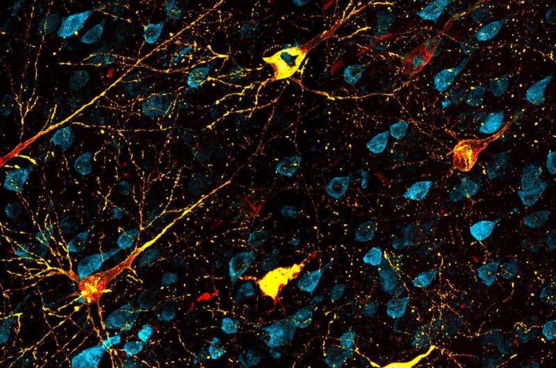 Animal model opens way to test Alzheimer's disease therapies