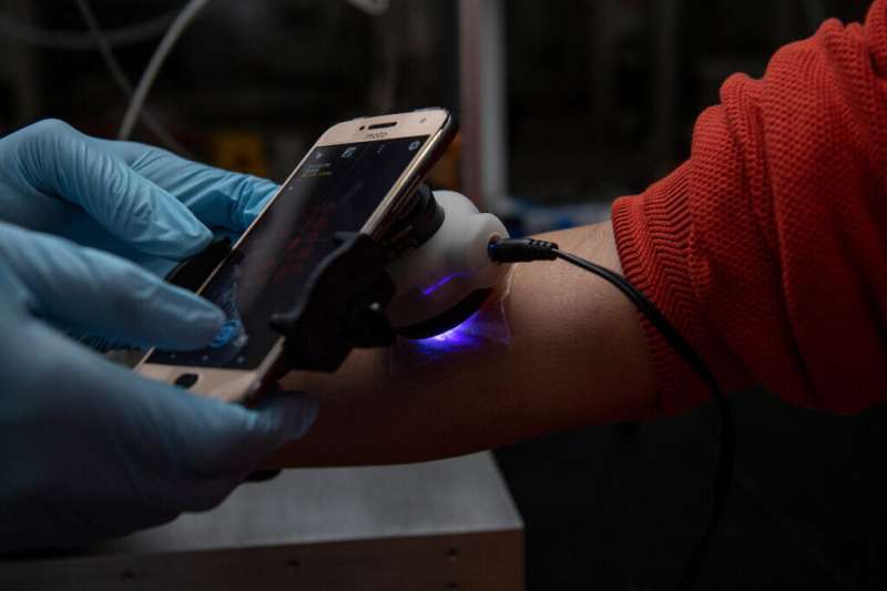 Biomedical engineers develop ‘smart’ sensor bandages