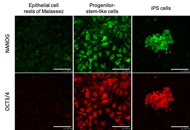 Direct reprogramming of oral epithelial cells into mesenchymal-like cells