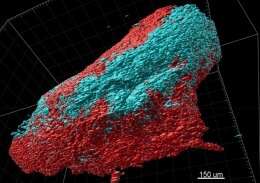 Human pancreatic cancer model offers new opportunities for testing drugs