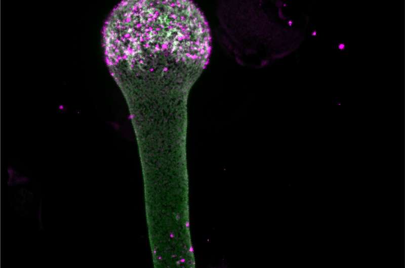 Membrane building blocks play decisive role in controlling cell growth