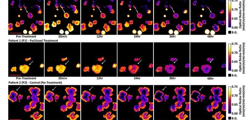 Redox imaging allows measurement of drug responses in lab-grown cancer samples