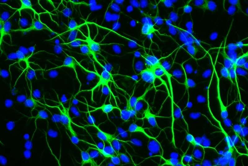 Study reveals how a longevity gene protects brain stem cells from stress