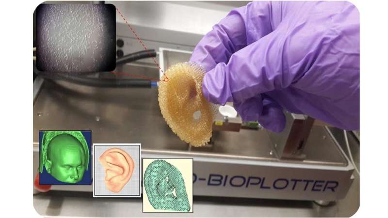 3D-printed organs could save lives by addressing the transplant shortage