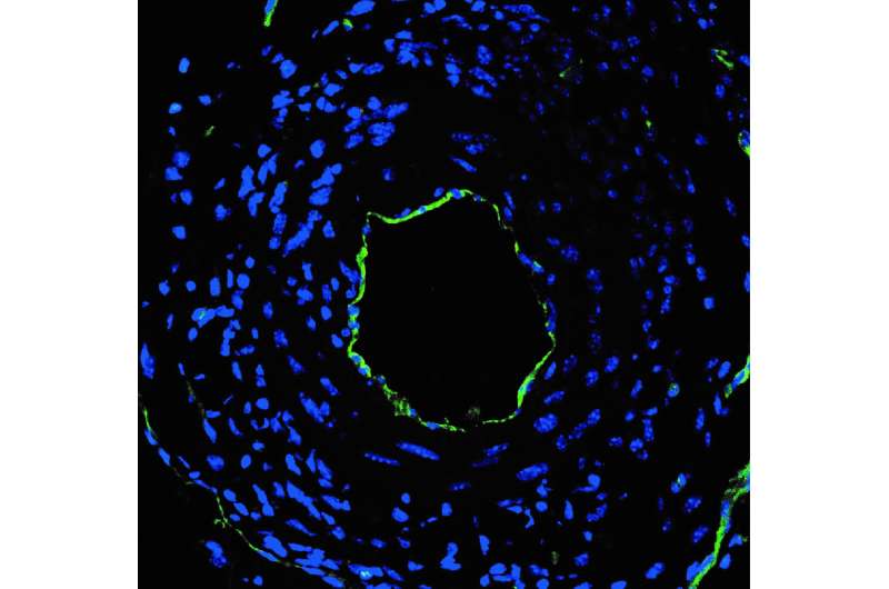 Cell-selective nanotherapy prevents post-angioplasty restenosis, promotes artery healing
