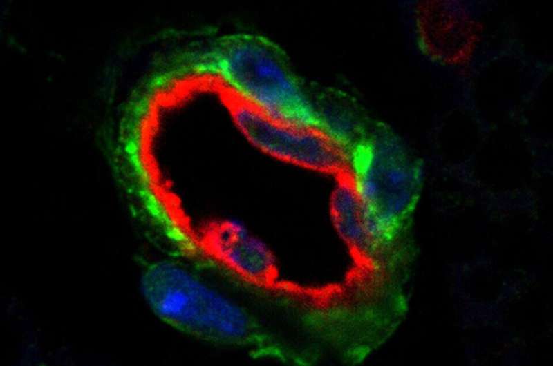 Two studies shed light on how, where body can add new fat cells