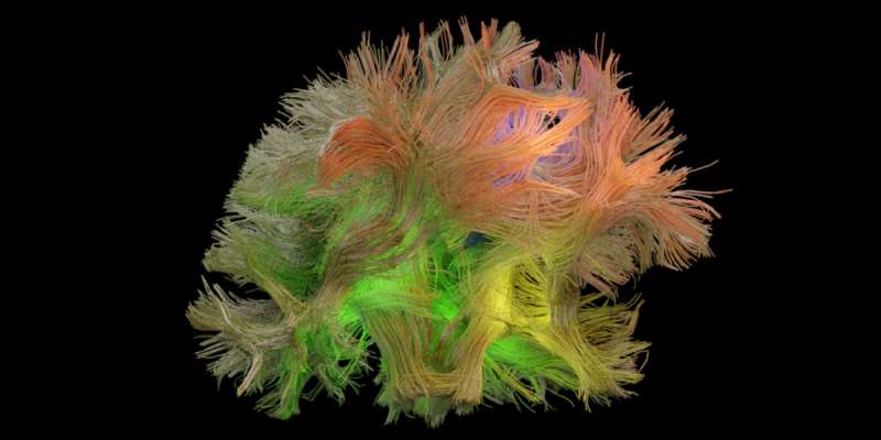 研究人员发现隐藏的大脑模式