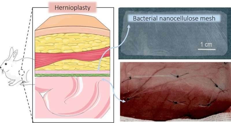 Bio-nanocellulose meshes improve hernia repair surgery