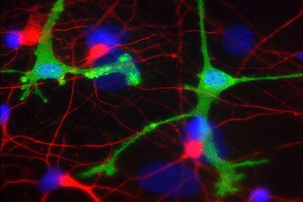 Experimental antibodies for Parkinson's, Alzheimer's may cause harmful inflammation