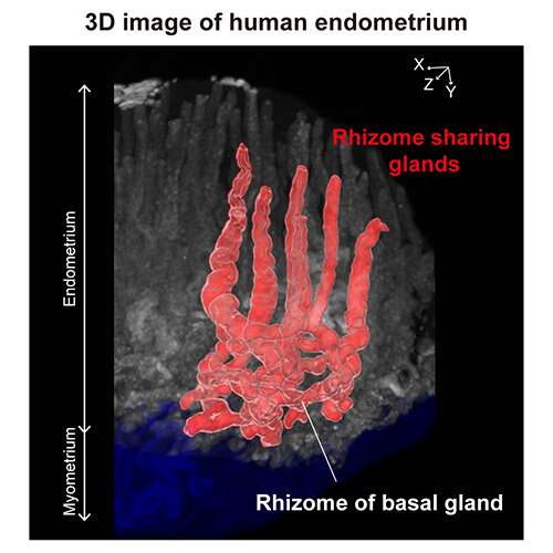 Study reveals the 3D structure of human uterine endometrium and adenomyosis tissue