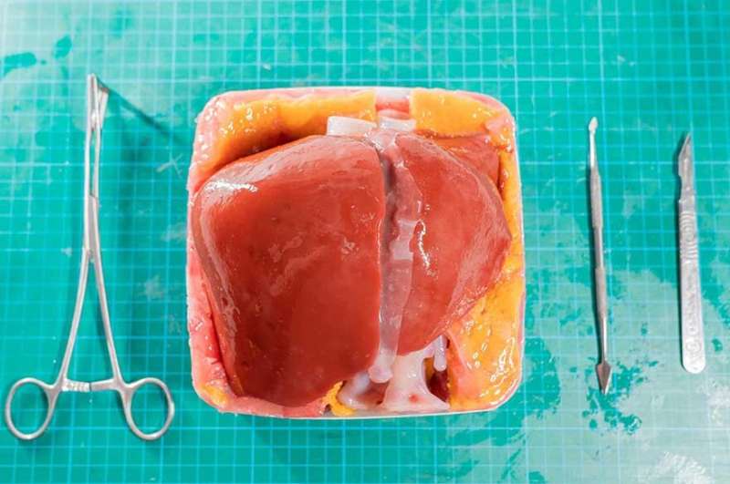 3D-printed liver to help surgeons prepare for life-saving operations