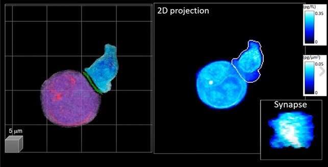 3D holographic microscopy powered by deep-learning deciphers cancer immunotherapy