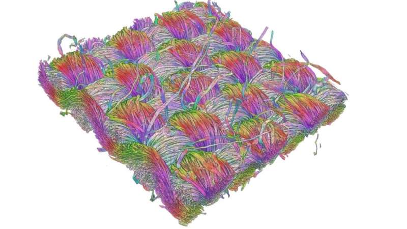 3-D images of fabric ‘sandwich’ can help measure textile friction