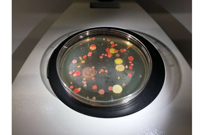 New bacterial culture methods could result in the discovery of new species