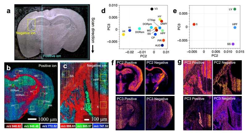 Want to diagnose brain diseases? A mass spectrometry imaging may one day help you