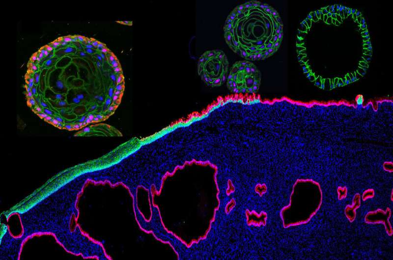 Novel organoid models illuminate the path to cervical cancers