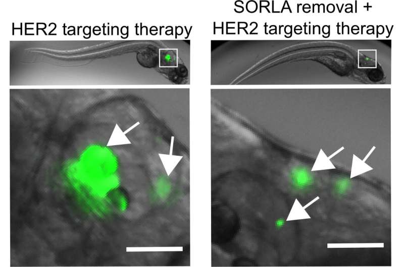 Removing SORLA protein from drug-resistant HER2-positive cancer cell lines