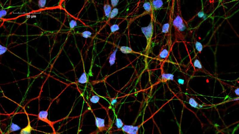 Neurons from blood cells enable researchers to test treatments for genetic brain disease