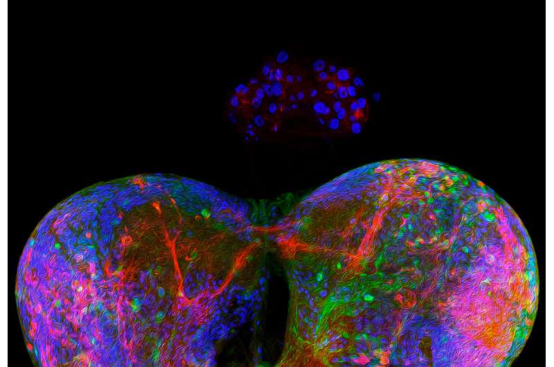 Discovery of a mechanism by which epithelial tumours cause developmental delays