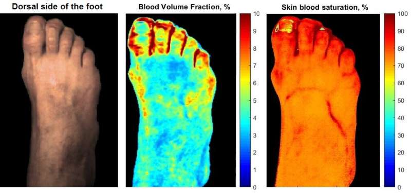 New method reveals the skin complications of diabetes