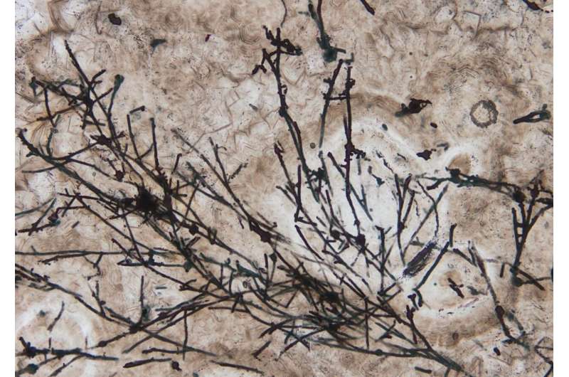 635 million-year-old fungi-like microfossil that bailed us out of an ice age discovered