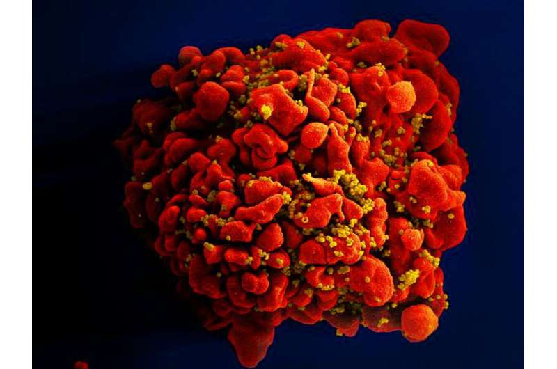 Researchers devise more efficient, enduring CAR gene therapy to combat HIV