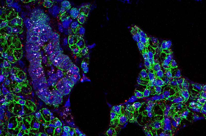 Scientists find evidence that novel coronavirus infects the mouth's cells